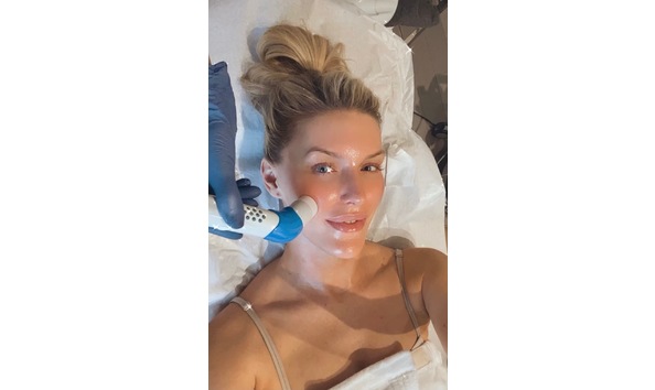 Big image collagen bar 6