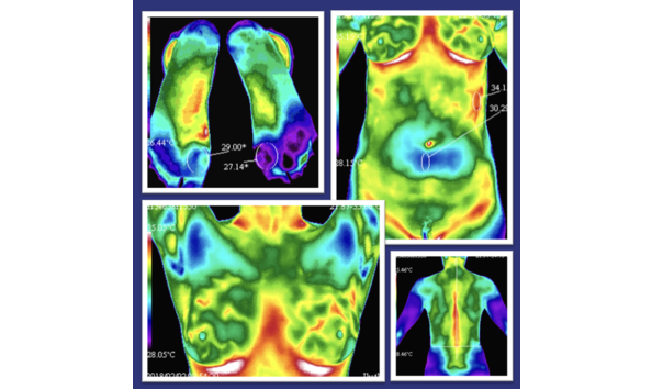 Big image thermography