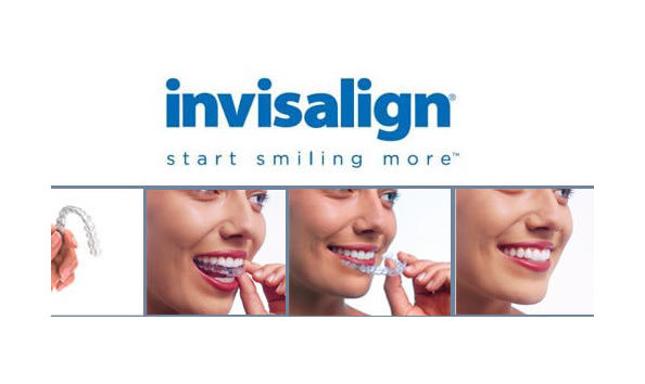 Big image original invisalign