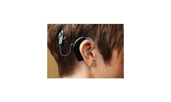 Big image cochlear