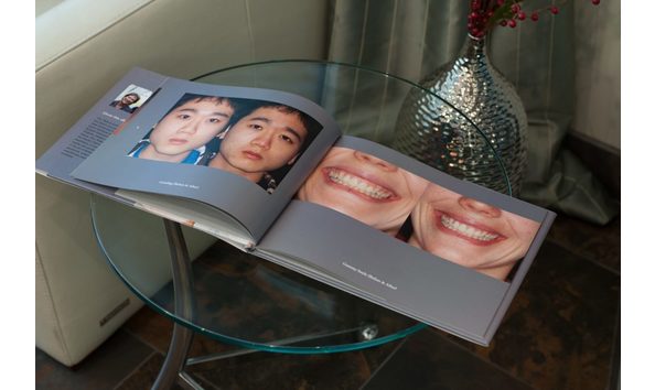 Big image facial rejuvenation book 9 1024x683