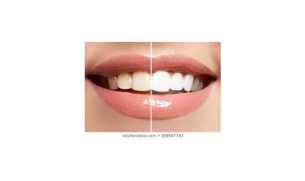 Big image whitening