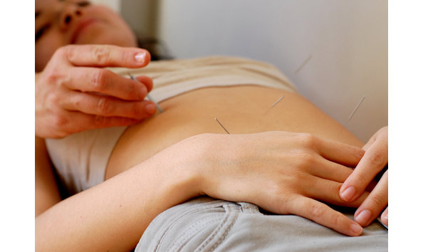 Big image acupuncture in philadelphia
