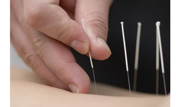 Big image acupuncture2