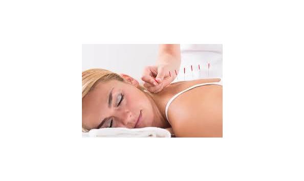 Big image acupuncture 2