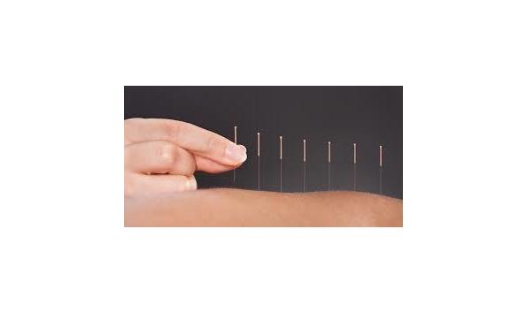 Big image acupuncture