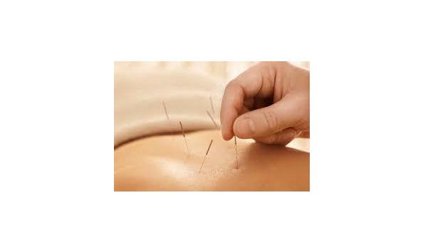 Big image acupun