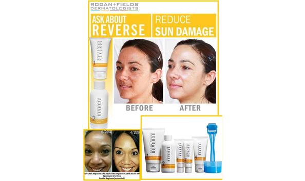 Big image rodan and fields reverse