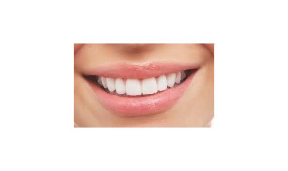 Big image teeth whitening pic  1