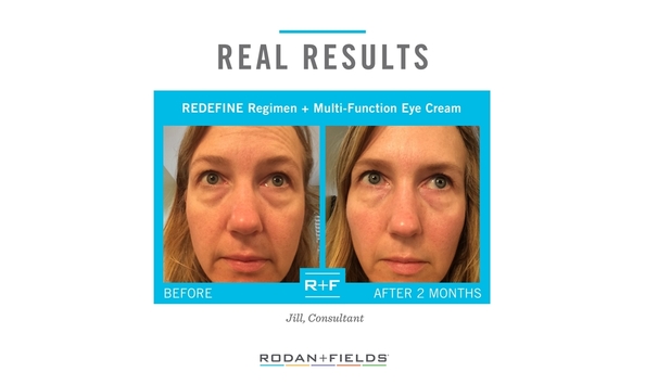 Big image real results   redefine   eye cream