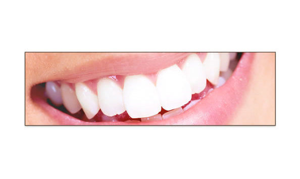 Big image pic services