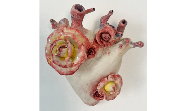 Big image derek reynoso heart